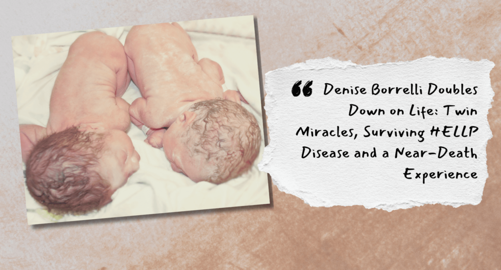 denise borrelli reveals near-death experience delivering twins
